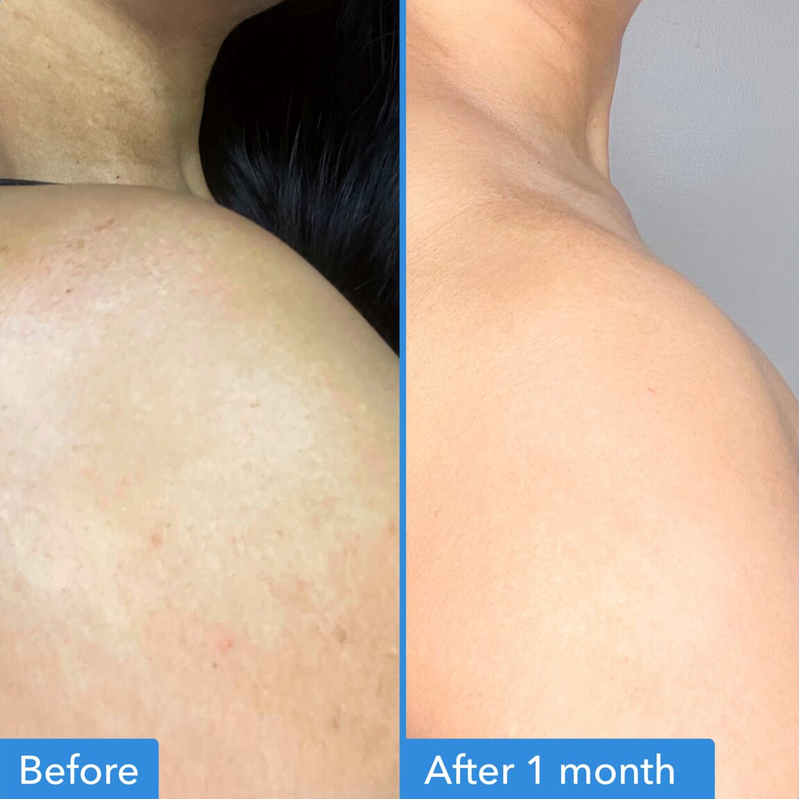 discoloration-correcting-body-treatment-x2 zb_p.jpg