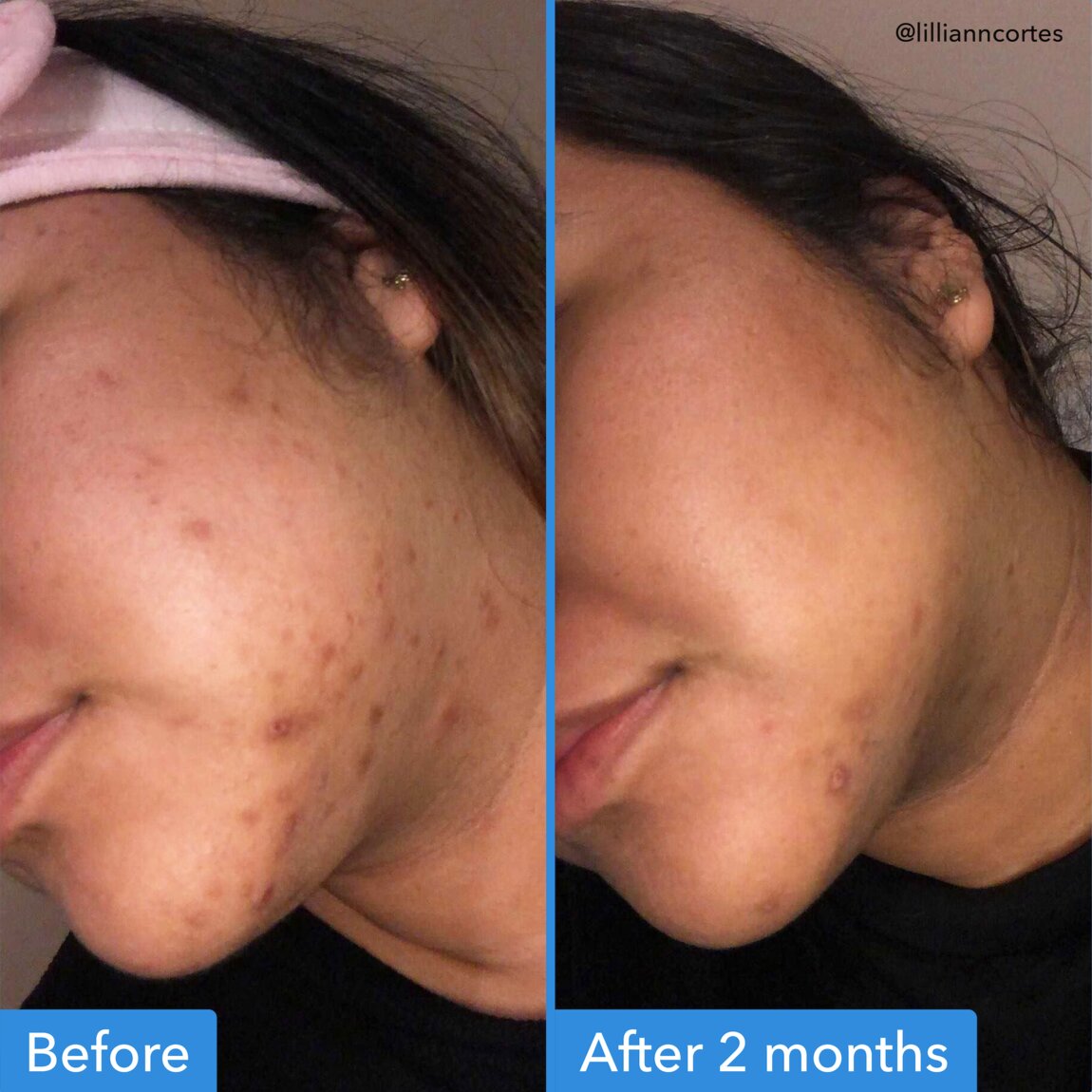 discoloration-correcting-serum-a5 zb_p.jpg