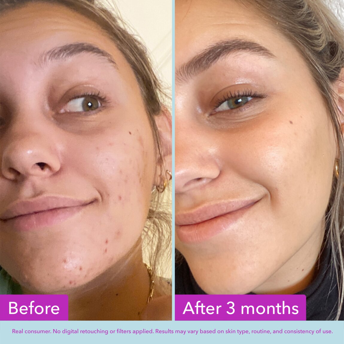 niacinamide-brightening-toner-s4 zb_p.jpg